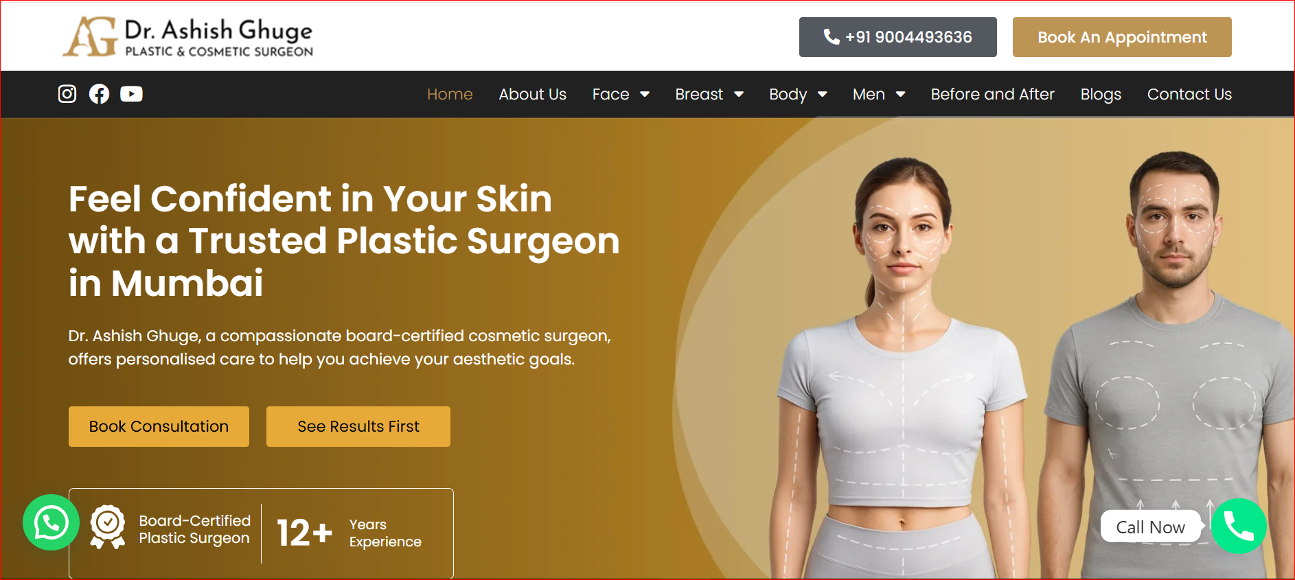 dr ashish ghuge plastic surgeon